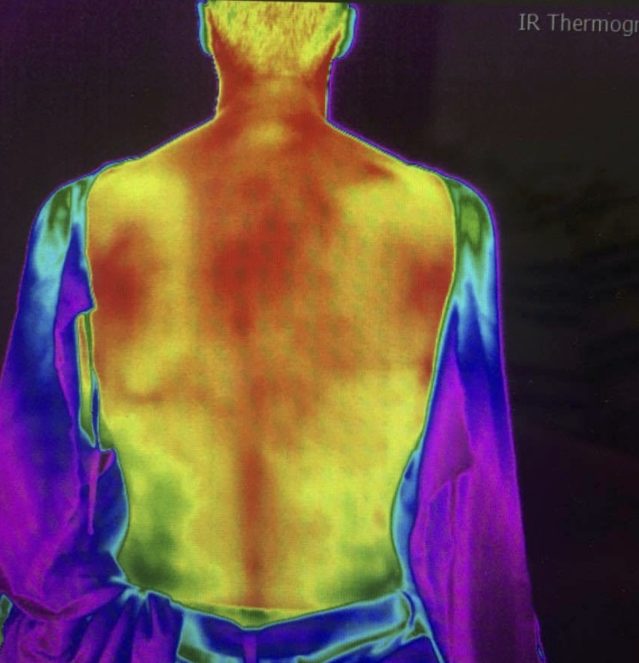 Infrared Thermography Spineology Chiropractic