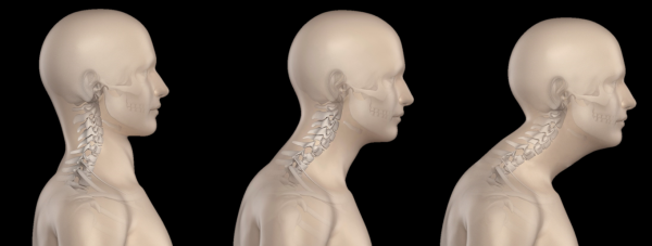 Do You Have Forward Head Posture Spineology Chiropractic 0802