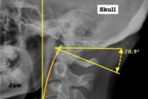 Imaging Technology