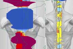 Infrared Thermography