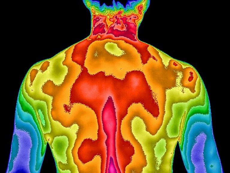 What Is Thermography? Spineology Chiropractic