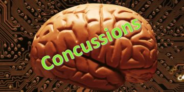 The Truth about Concussions