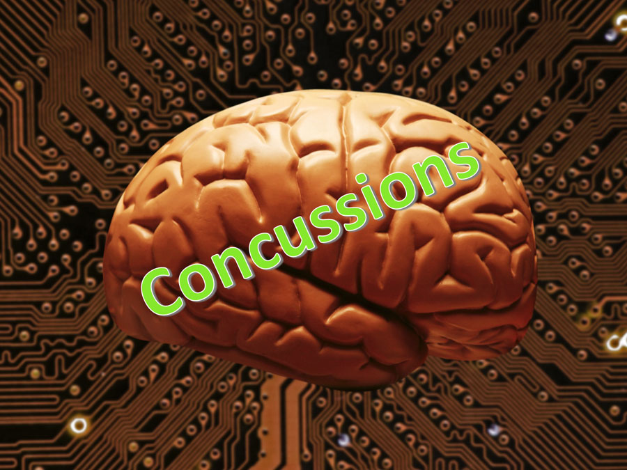 concussions