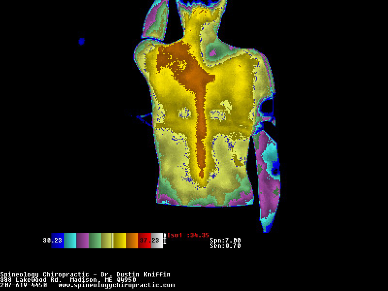 Thermogram